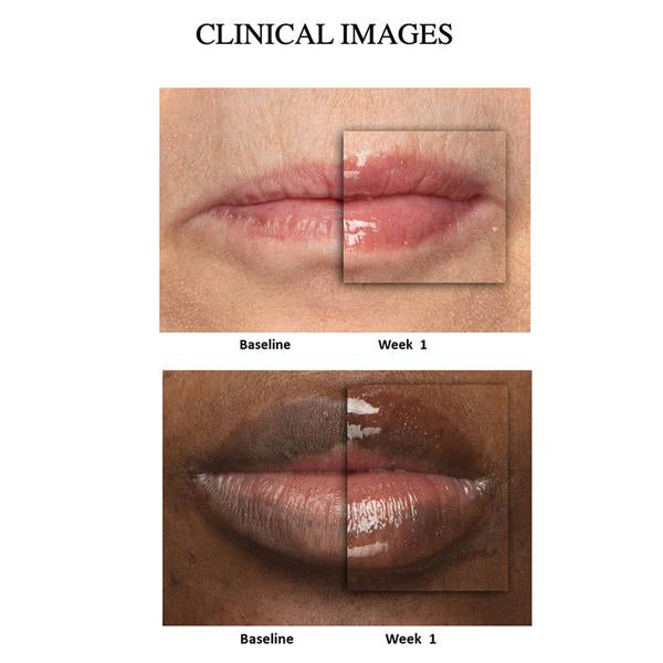 Nu Colour Peptide Pout